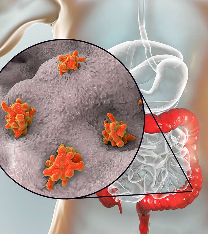 vedobi-causes-symptoms-and-home-remedies-for-dysentery