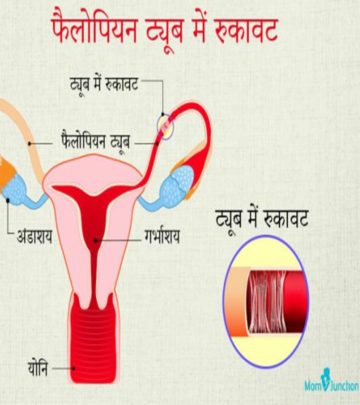 फैलोपियन ट्यूब रुकावट: लक्षण, उपचार व लागत | Fallopian Tube Blockage Treatment In Hindi_image