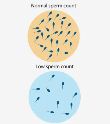 शुक्राणु की कमी (Low Sperm Count) : लक्षण, निदान और इलाज | Sperm Motility In Hindi_image