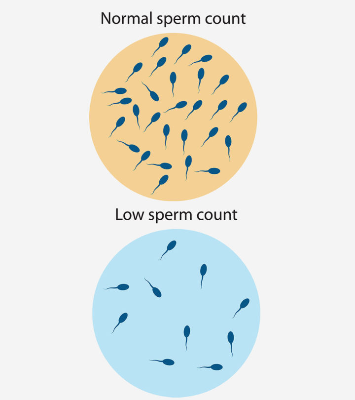 शुक्राणु की कमी (Low Sperm Count) : लक्षण, निदान और इलाज | Sperm Motility In Hindi