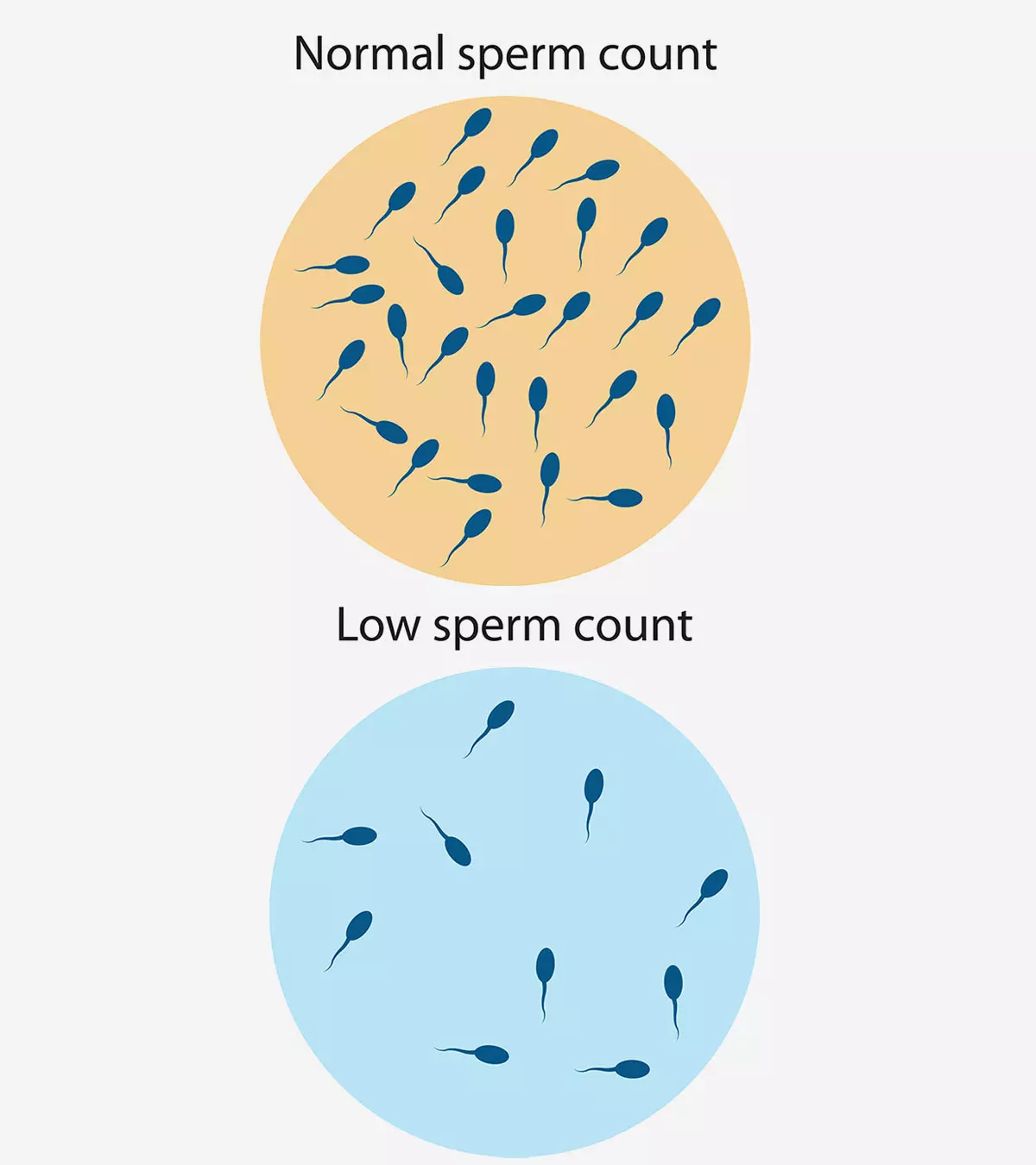 शुक्राणु की कमी (Low Sperm Count) : लक्षण, निदान और इलाज | Sperm Motility In Hindi_image