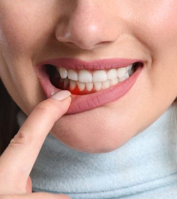 पायरिया के कारण, लक्षण और घरेलू उपाय – Periodontitis (Gum Disease) Causes, Symptoms and Home Remedies in Hindi_image