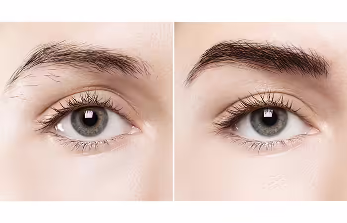 A before and after picture of a woman who underwent eyebrow microblading