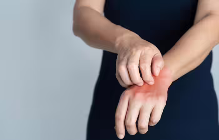 Relieving itching and fungal infections