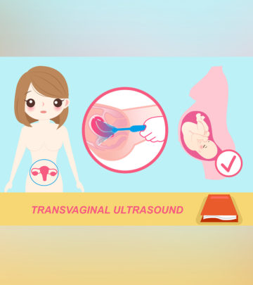 ट्रांसवेजाइनल अल्ट्रासाउंड स्कैन: प्रक्रिया, परिणाम व लागत | TVS Ultrasound Test In Hindi_image