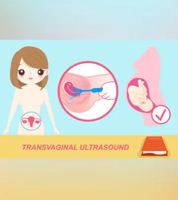 ट्रांसवेजाइनल अल्ट्रासाउंड स्कैन: प्रक्रिया, परिणाम व लागत | TVS Ultrasound Test In Hindi_image