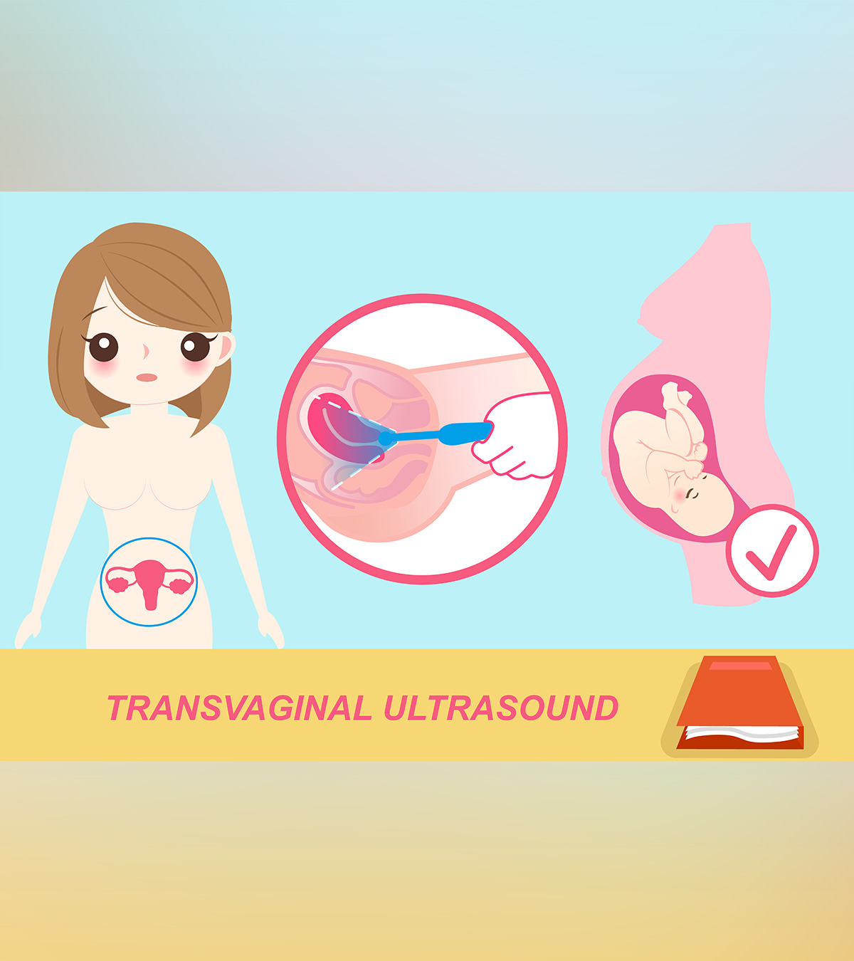 ट्रांसवेजाइनल अल्ट्रासाउंड स्कैन: प्रक्रिया, परिणाम व लागत | TVS Ultrasound Test In Hindi_image