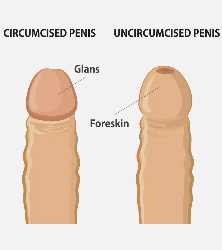 Circumcision In Teenagers: Facts, Complications And Care Tips_image