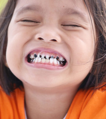 बच्चों के दांतों में कीड़े :  कारण, लक्षण, ट्रीटमेंट व  घरेलू उपाय | Tooth Decay In Kids In Hindi_image