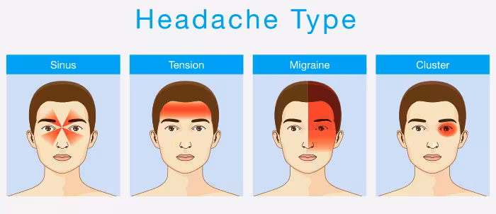 Types of Headache in Hindi