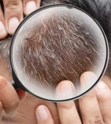 सफेद बालों से छुटकारा पाने के घरेलू इलाज – White Hair (Safed Baal) Treatment at Home in Hindi_image