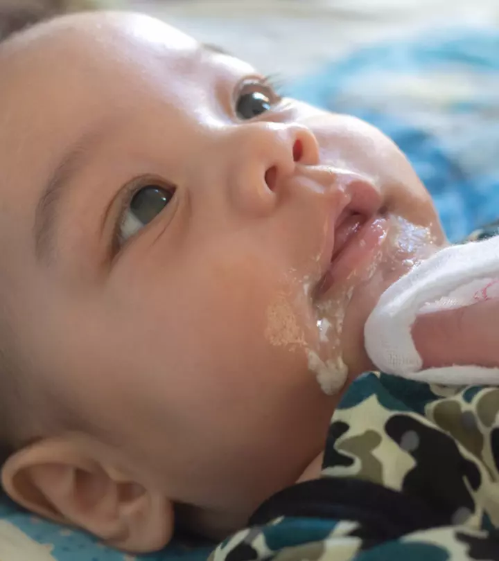 Baby Spitting Up Curdled Milk: What’s Normal, Causes And Treatment_image