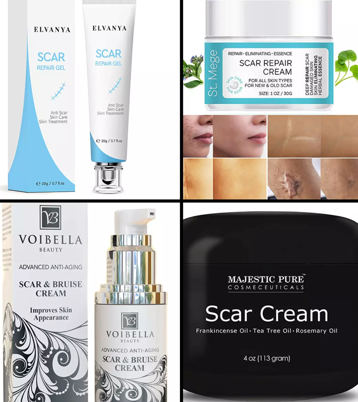 11 Best Scar Removal Creams In 2024, As Per Dermatologist