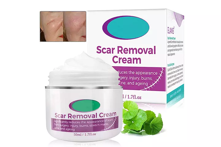 Chinoxia Scar Cream