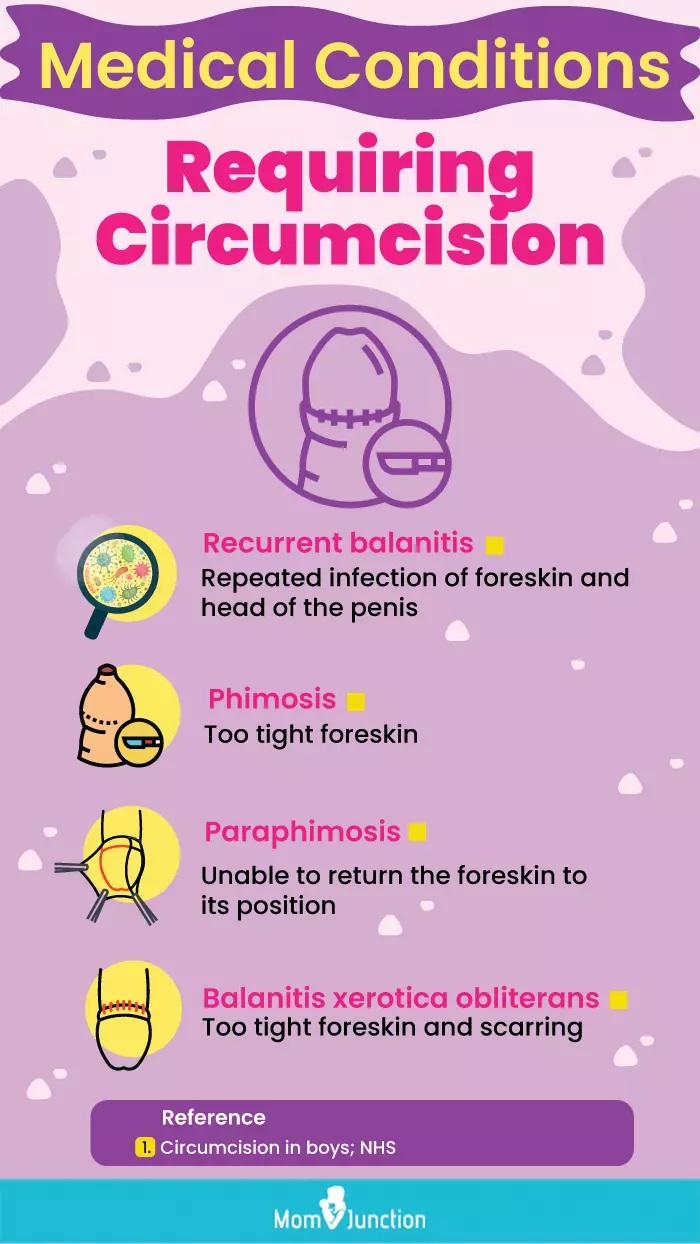 medical conditions requiring circumcision (infographic)