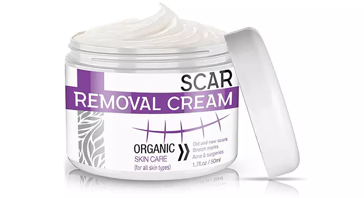 Parrots Treasure Scar Cream