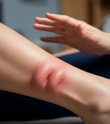 Effective Home Remedies for Charlie Horse (Muscle Cramps) – Causes & Natural Treatments Discover natural remedies, causes, prevention tips, and expert advice for relieving and preventing painful muscle cramps (charley horses).