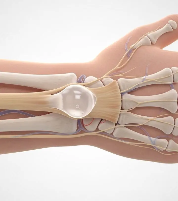 Comprehensive guide to understanding, diagnosing, and treating ganglion cysts effectively