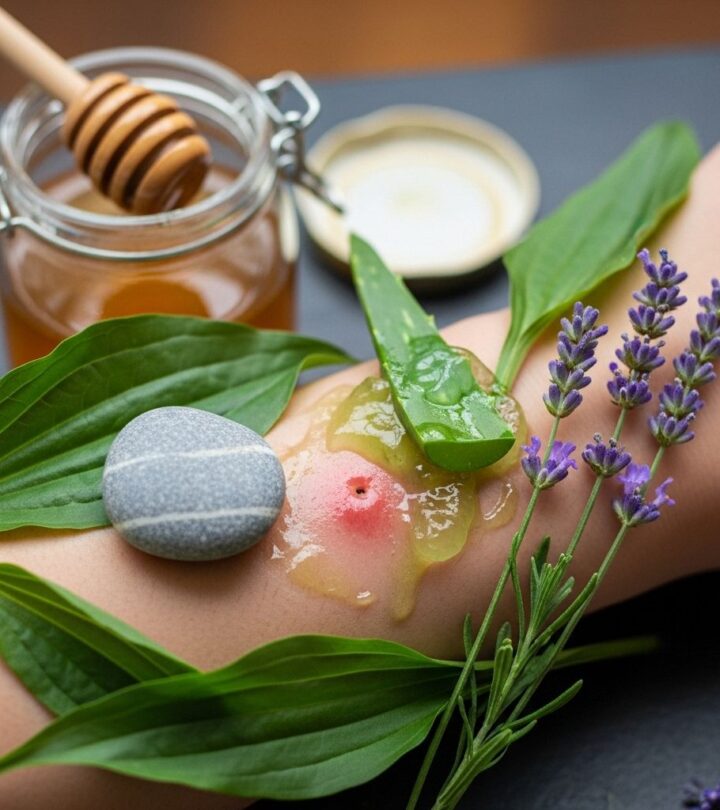 Effective Home Remedies for Spider Bites: Soothing and Healing Naturally Relieve pain, reduce swelling, and help healing from spider bites with proven home remedies and simple treatments.