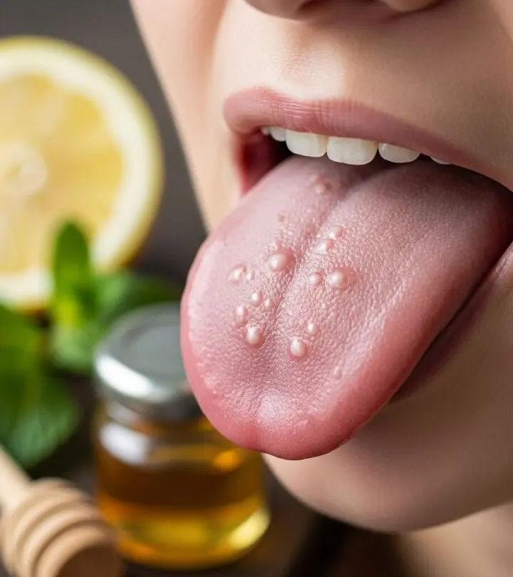 Effective Home Remedies to Treat Blisters on Your Tongue Discover natural ways to soothe and heal tongue blisters using safe, science-backed home remedies for fast relief.