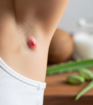Home Remedies For Painful Armpit Lumps: Natural Treatments, Causes, and Prevention
