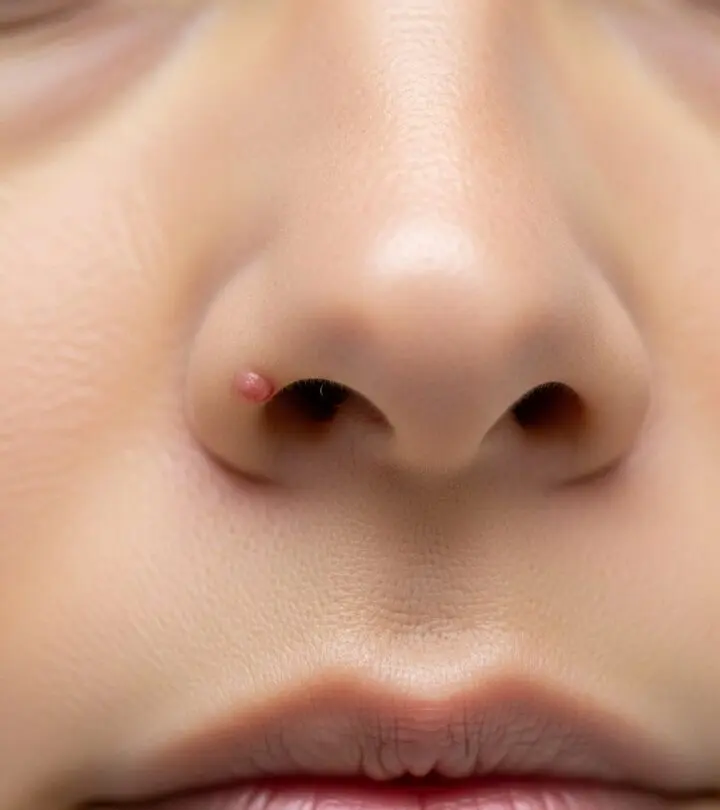 Explore causes, treatments, and safe home remedies for painful pimples inside the nose, plus preventative strategies and critical FAQs.