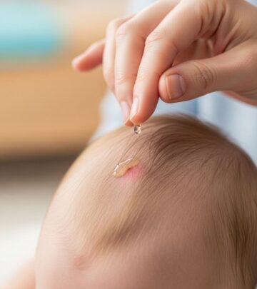 How To Get Rid Of Cradle Cap: Effective Home Remedies & Expert Tips