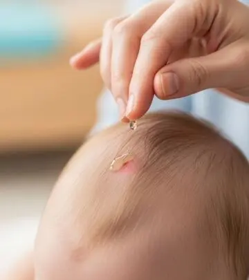 How To Get Rid Of Cradle Cap: Effective Home Remedies & Expert Tips A comprehensive guide to managing cradle cap in babies, including gentle remedies and medical advice for parents.