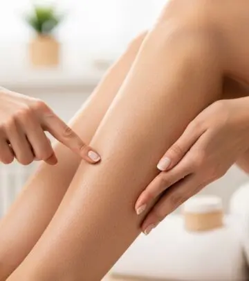 How to Get Rid of Strawberry Legs: Complete Guide Discover effective methods to eliminate strawberry legs and achieve smooth skin