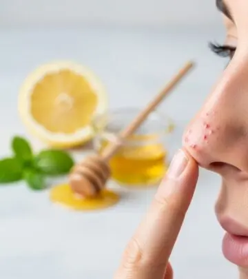 How to Remove Nose Pimples: Effective Home Remedies Guide Discover proven natural remedies and expert tips to eliminate stubborn nose pimples quickly and safely.