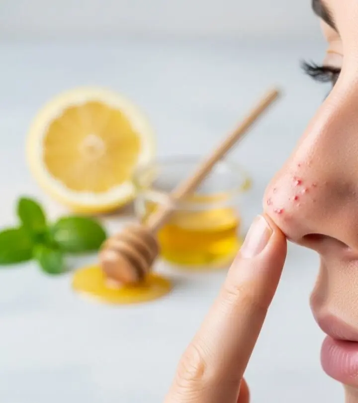 How to Remove Nose Pimples: Effective Home Remedies Guide Discover proven natural remedies and expert tips to eliminate stubborn nose pimples quickly and safely.