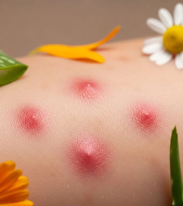 Red Spots On Skin: Natural Remedies & Treatment Guide Discover effective natural remedies and expert tips to fade red spots and achieve clearer, healthier skin.