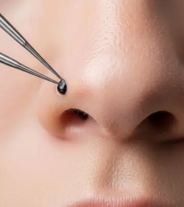 How To Remove Deep Blackheads Safely And Effectively Discover expert-backed techniques to eliminate deep blackheads and maintain clear, healthy skin through safe, science-driven methods.