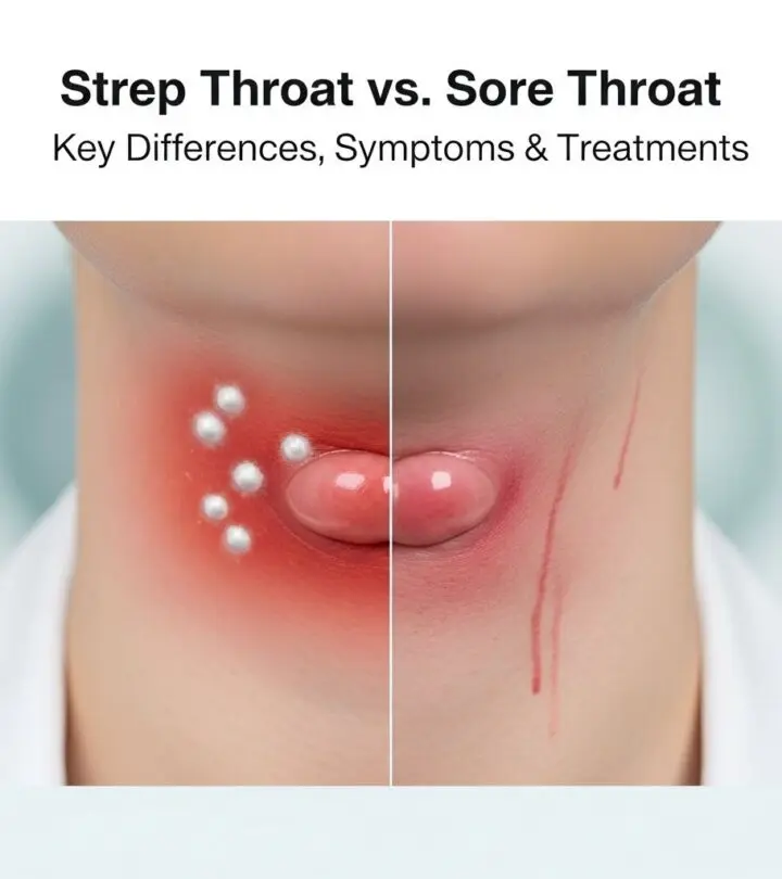 Strep Throat vs. Sore Throat: Key Differences, Symptoms & Treatments Learn how to distinguish between strep throat and a sore throat, their causes, symptoms, prevention, and treatments.